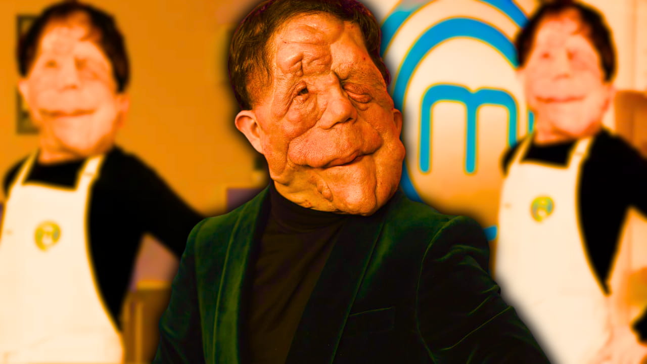 What Happened To Adam Pearson? Breaking the Mold- Challenging Hollywood ...