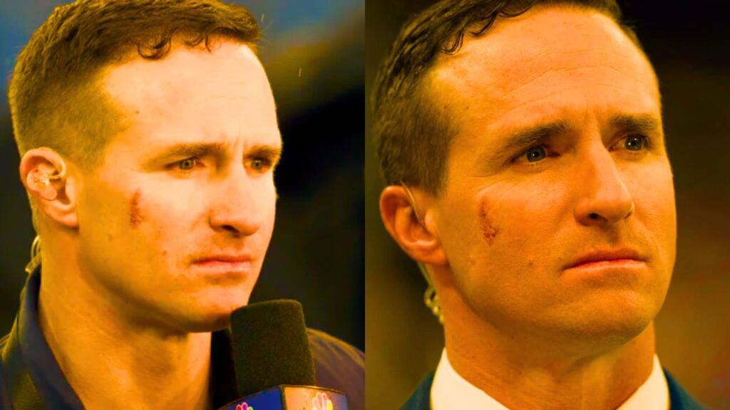 What Happened To Drew Brees Face