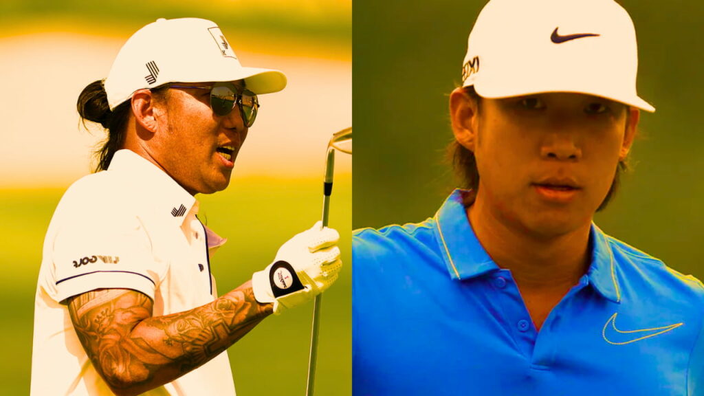 What Happened to Anthony Kim's Face